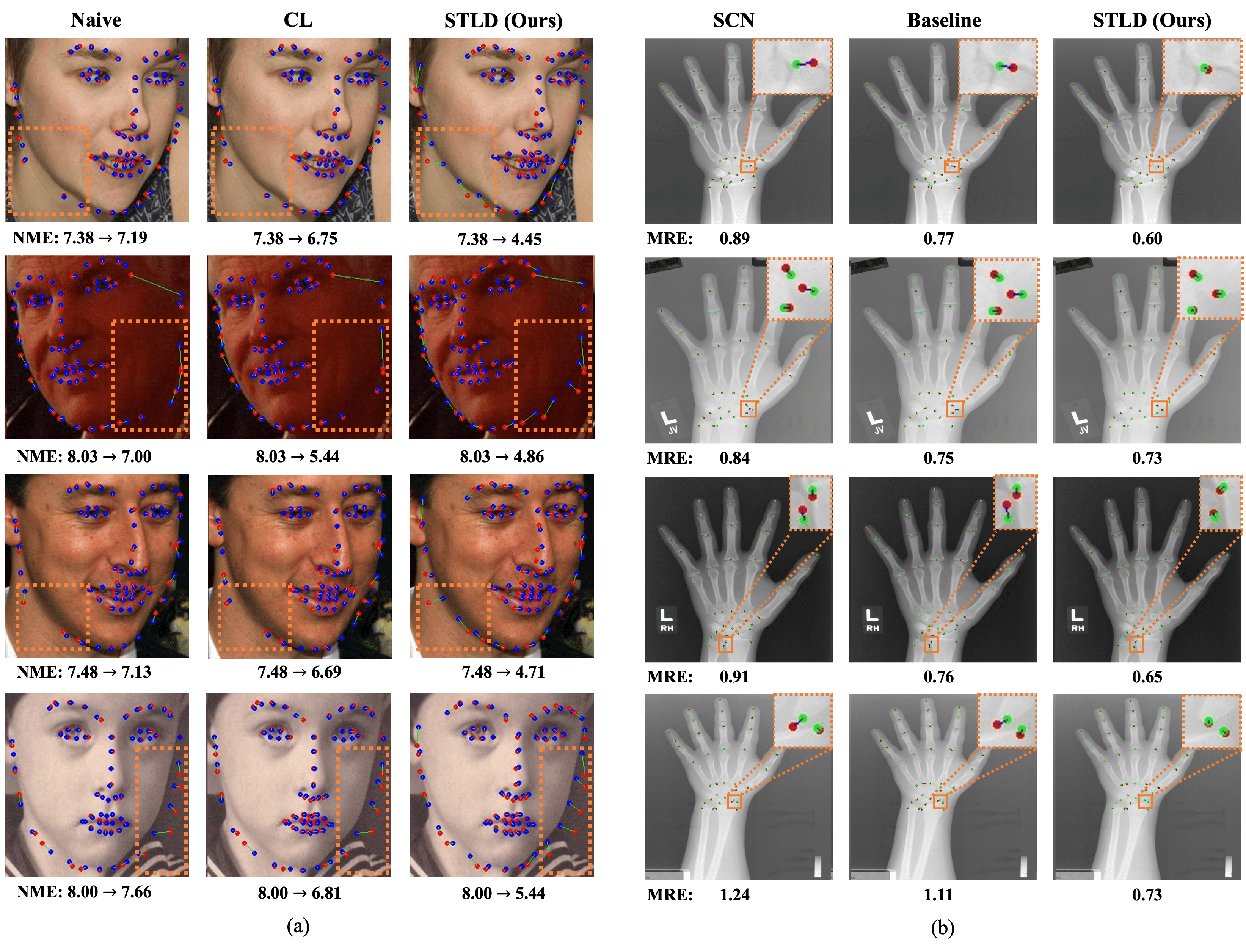 Figure 7. (a) Visualized unlabeled samples from 300W, with pseudo-labels from the first (red dots) and the last self-training round (blue dots). The naive method (left), CL (middle), and STLD (right) all use the same base model HM, trained with 1.6% labeled data. (b) Visualized test samples from Hand, with ground-truths (green dots), predictions (red dots), and the distances between them (blue lines). SCN (left) and the baseline HM (middle) are trained in supervised learning while STLD (right) is trained in omni-supervised learning.