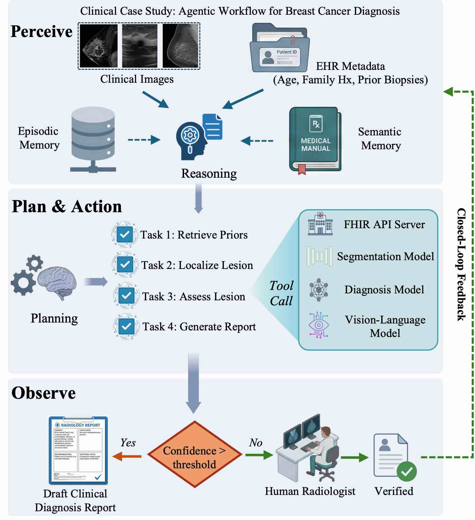 Agentic workflow for breast cancer diagnosis